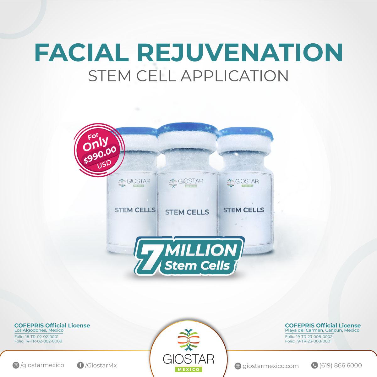 Facial_Rejuvenation_Stem_Cells_Mexico Facial Rejuvenation at Giostar Mexico Stem Cell Therapy